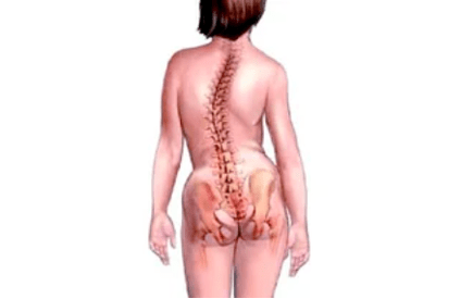 Gimdos kaklelio osteochondrozės vystymosi priežastys