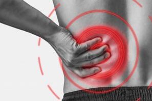 Juosmens stuburo osteochondrozė