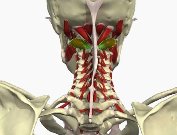 Vail arterijos sindromas